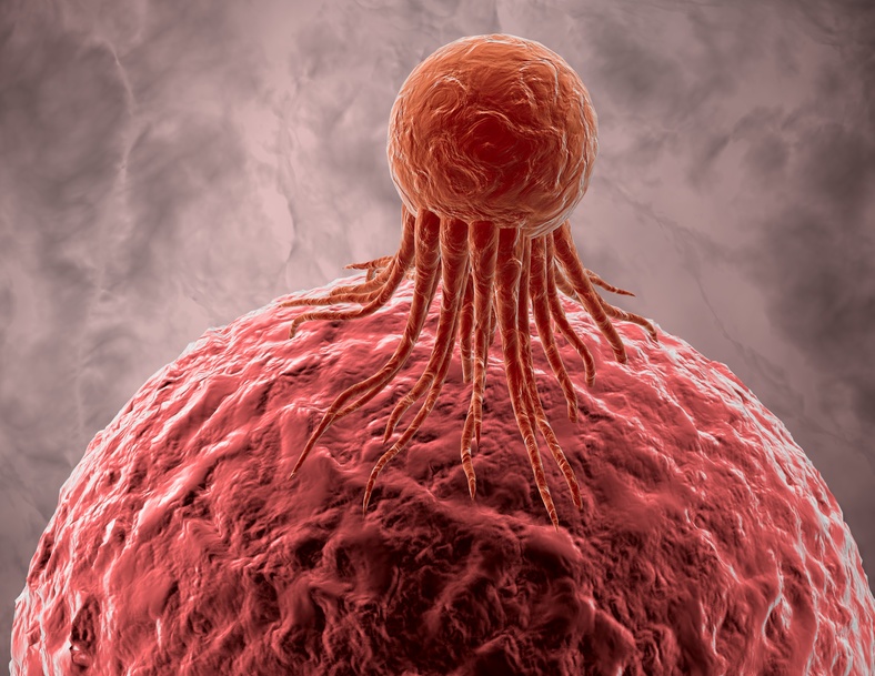 がん細胞のイメージ